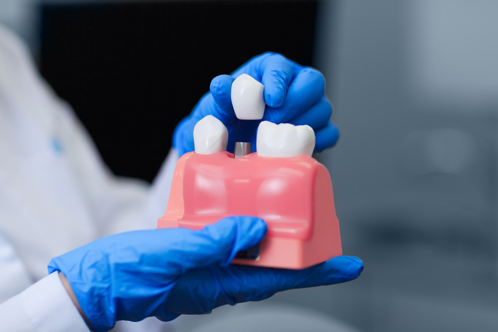 dentist holding implant model in his clinic